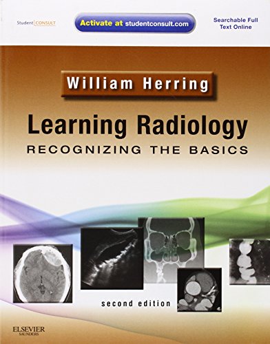 Learning Radiology: Recognizing the Basics. With STUDENT CONSULT Access