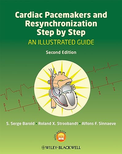 Cardiac Pacemakers and Resynchronization Therapy Step-by-Step: An Illustrated Guide