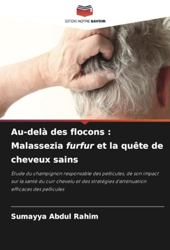 Au-delà des flocons : Malassezia furfur et la quête de cheveux sains: Étude du champignon responsable des pellicules, de son impact sur la santé du ... d'atténuation efficaces des pellicules von Editions Notre Savoir