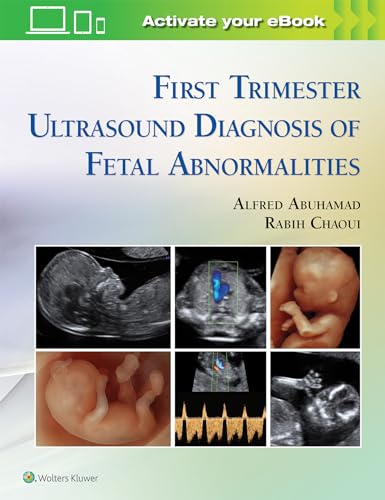 First Trimester Ultrasound Diagnosis of Fetal Abnormalities von LWW