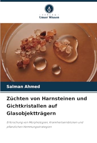 Züchten von Harnsteinen und Gichtkristallen auf Glasobjektträgern: Erforschung von Morphologien, Krankheitseinblicken und pflanzlichen Hemmungsstrategien von Verlag Unser Wissen