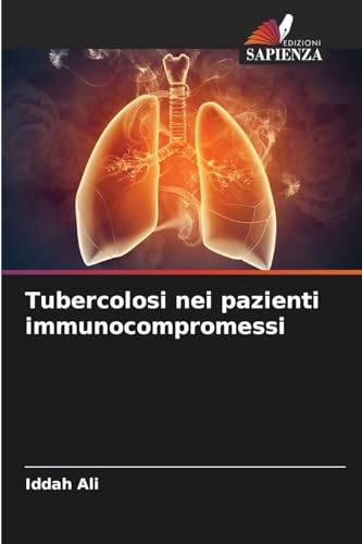 Tubercolosi nei pazienti immunocompromessi: DE von Edizioni Sapienza