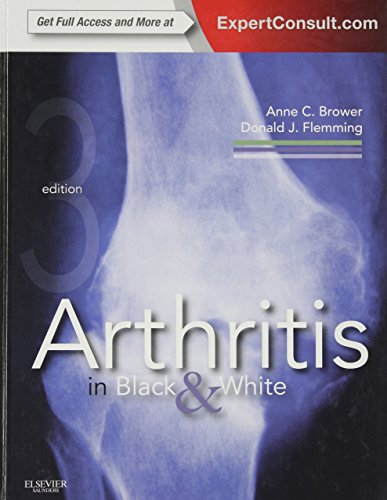 Arthritis in Black and White: Expert Consult - Online and Print von Saunders