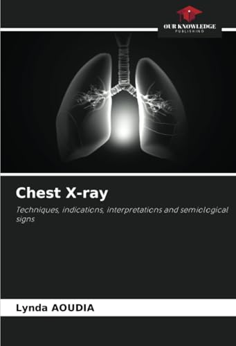 Chest X-ray: Techniques, indications, interpretations and semiological signs von Our Knowledge Publishing