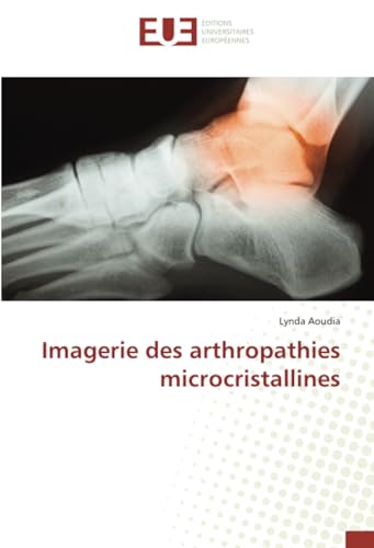 Imagerie des arthropathies microcristallines von Éditions universitaires européennes