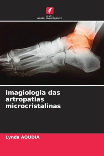 Imagiologia das artropatias microcristalinas: DE von Edições Nosso Conhecimento