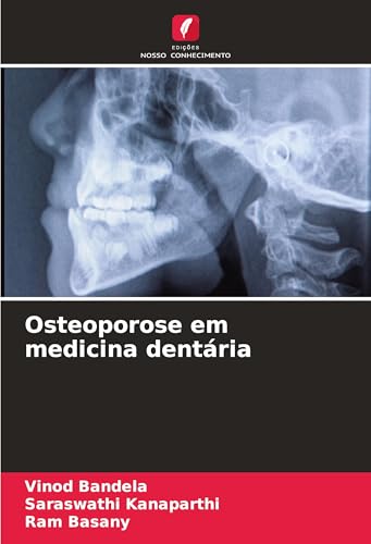 Osteoporose em medicina dentária von Edições Nosso Conhecimento