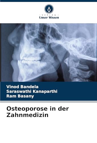 Osteoporose in der Zahnmedizin von Verlag Unser Wissen