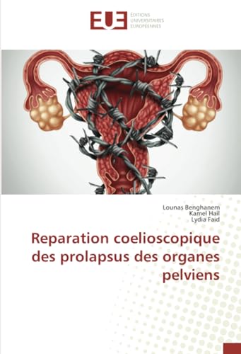 Reparation coelioscopique des prolapsus des organes pelviens von Éditions universitaires européennes