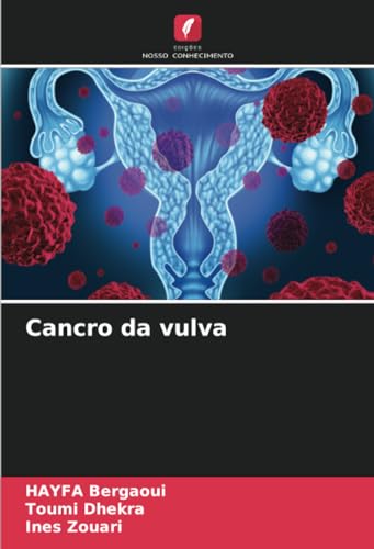 Cancro da vulva: DE von Edições Nosso Conhecimento