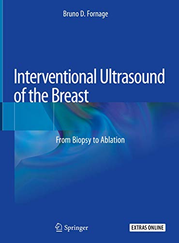 Interventional Ultrasound of the Breast: From Biopsy to Ablation von Springer