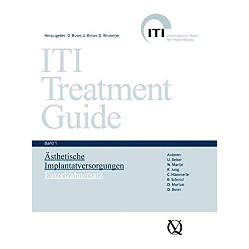 ITI Treatment Guide Band 1: Ästhetische Implantattherapie: Einzelzahnersatz (ITI Treatment Guide: Deutsche Ausgabe)