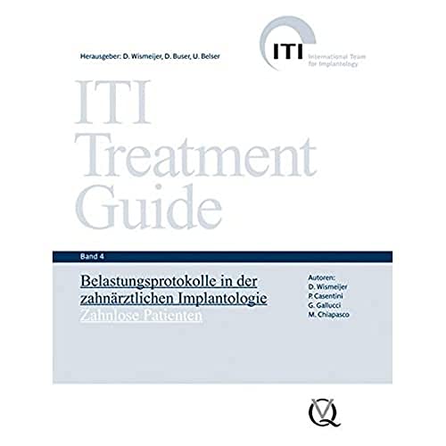 ITI Treatment Guide Band 4: Belastungsprotokolle in der zahnärztlichen Implantologie - Zahnlose Patienten (ITI Treatment Guide: Deutsche Ausgabe) von Quintessenz Verlag