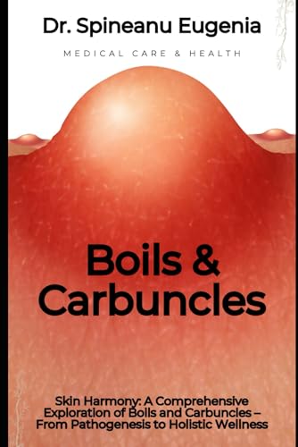 A Comprehensive Exploration of Boils and Carbuncles – From Pathogenesis to Holistic Wellness (Medical care and health) von Independently published