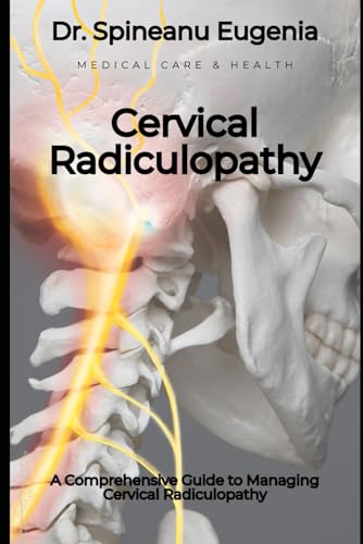 A Comprehensive Guide to Managing Cervical Radiculopathy von Independently published