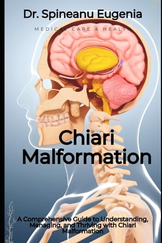A Comprehensive Guide to Understanding, Managing, and Thriving with Chiari Malformation von Independently published
