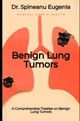 A Comprehensive Treatise on Benign Lung Tumors (Medical care and health) von Independently published