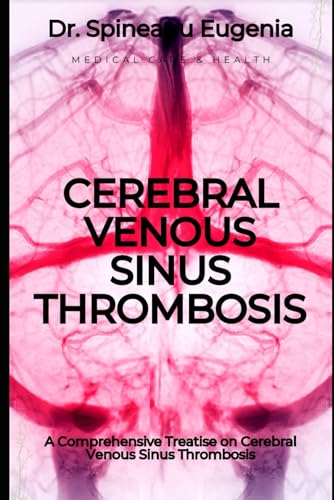 A Comprehensive Treatise on Cerebral Venous Sinus Thrombosis von Independently published