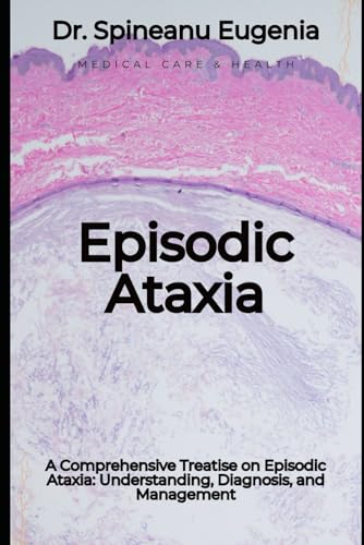 A Comprehensive Treatise on Episodic Ataxia: Understanding, Diagnosis, and Management von Independently published