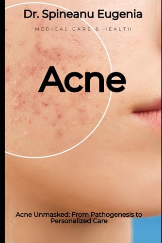 Acne Unmasked: From Pathogenesis to Personalized Care (Medical care and health) von Independently published
