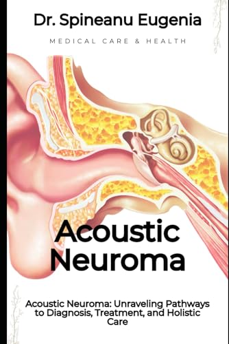 Acoustic Neuroma: Unraveling Pathways to Diagnosis, Treatment, and Holistic Care (Medical care and health) von Independently published