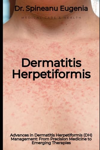 Advances in Dermatitis Herpetiformis (DH) Management: From Precision Medicine to Emerging Therapies von Independently published