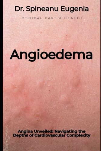 Angioedema Unveiled: A Comprehensive Exploration of Mechanisms, Management, and Future Frontiers (Medical care and health) von Independently published