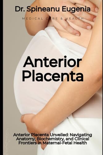 Anterior Placenta Unveiled: Navigating Anatomy, Biochemistry, and Clinical Frontiers in Maternal-Fetal Health (Medical care and health) von Independently published