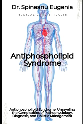 Antiphospholipid Syndrome: Unraveling the Complexities of Pathophysiology, Diagnosis, and Holistic Management (Medical care and health) von Independently published