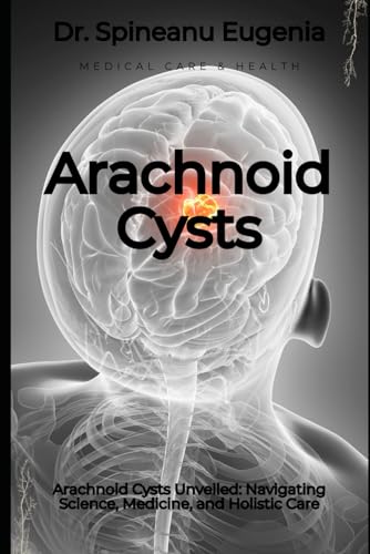 Arachnoid Cysts Unveiled: Navigating Science, Medicine, and Holistic Care (Medical care and health) von Independently published