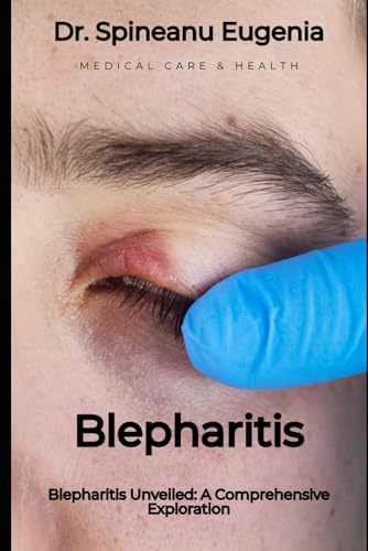 Blepharitis Unveiled: A Comprehensive Exploration (Medical care and health) von Independently published