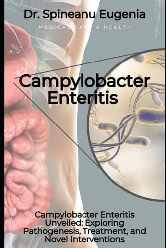 Campylobacter Enteritis Unveiled: Exploring Pathogenesis, Treatment, and Novel Interventions (Medical care and health) von Independently published