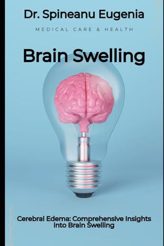 Cerebral Edema: Comprehensive Insights into Brain Swelling (Medical care and health) von Independently published