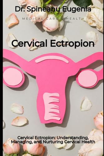 Cervical Ectropion: Understanding, Managing, and Nurturing Cervical Health von Independently published