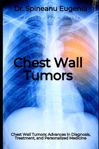 Chest Wall Tumors: Advances in Diagnosis, Treatment, and Personalized Medicine von Independently published