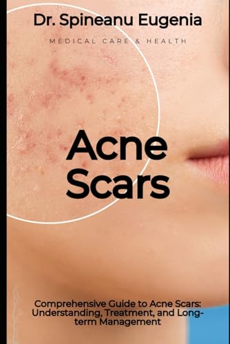Comprehensive Guide to Acne Scars: Understanding, Treatment, and Long-term Management (Medical care and health) von Independently published