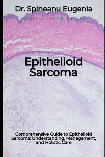 Comprehensive Guide to Epithelioid Sarcoma: Understanding, Management, and Holistic Care von Independently published