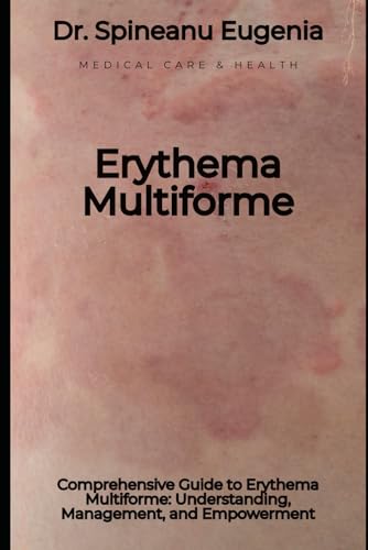 Comprehensive Guide to Erythema Multiforme: Understanding, Management, and Empowerment von Independently published
