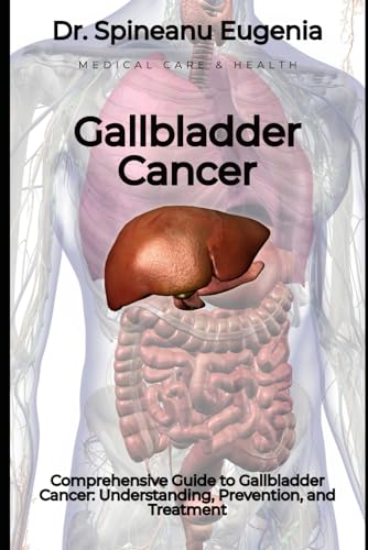 Comprehensive Guide to Gallbladder Cancer: Understanding, Prevention, and Treatment von Independently published