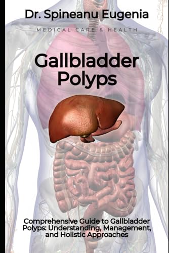 Comprehensive Guide to Gallbladder Polyps: Understanding, Management, and Holistic Approaches von Independently published
