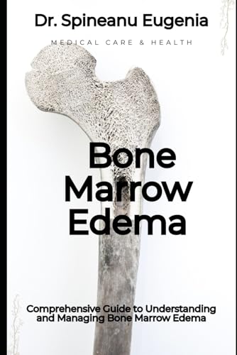 Comprehensive Guide to Understanding and Managing Bone Marrow Edema (Medical care and health) von Independently published