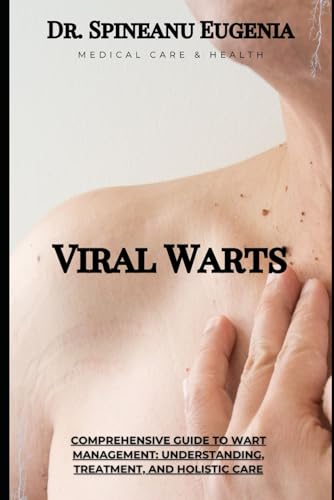 Comprehensive Guide to Wart Management: Understanding, Treatment, and Holistic Care (Medical care and health) von Independently published