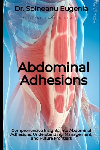 Comprehensive Insights into Abdominal Adhesions: Understanding, Management, and Future Frontiers (Medical care and health) von Independently published