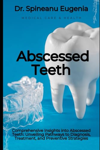 Comprehensive Insights into Abscessed Teeth: Unveiling Pathways to Diagnosis, Treatment, and Preventive Strategies (Medical care and health) von Independently published
