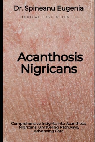 Comprehensive Insights into Acanthosis Nigricans: Unraveling Pathways, Advancing Care (Medical care and health) von Independently published