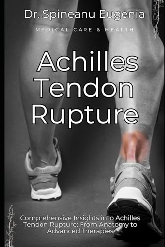 Comprehensive Insights into Achilles Tendon Rupture: From Anatomy to Advanced Therapies (Medical care and health) von Independently published