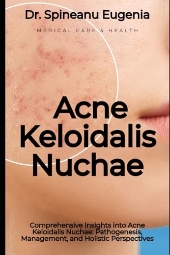 Comprehensive Insights into Acne Keloidalis Nuchae: Pathogenesis, Management, and Holistic Perspectives (Medical care and health) von Independently published