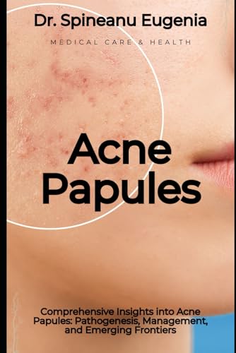 Comprehensive Insights into Acne Papules: Pathogenesis, Management, and Emerging Frontiers (Medical care and health) von Independently published