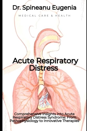 Comprehensive Insights into Acute Respiratory Distress Syndrome: From Pathophysiology to Innovative Therapies (Medical care and health) von Independently published