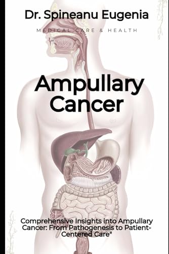 Comprehensive Insights into Ampullary Cancer: From Pathogenesis to Patient-Centered Care" (Medical care and health) von Independently published